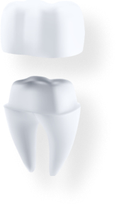 dental crowns